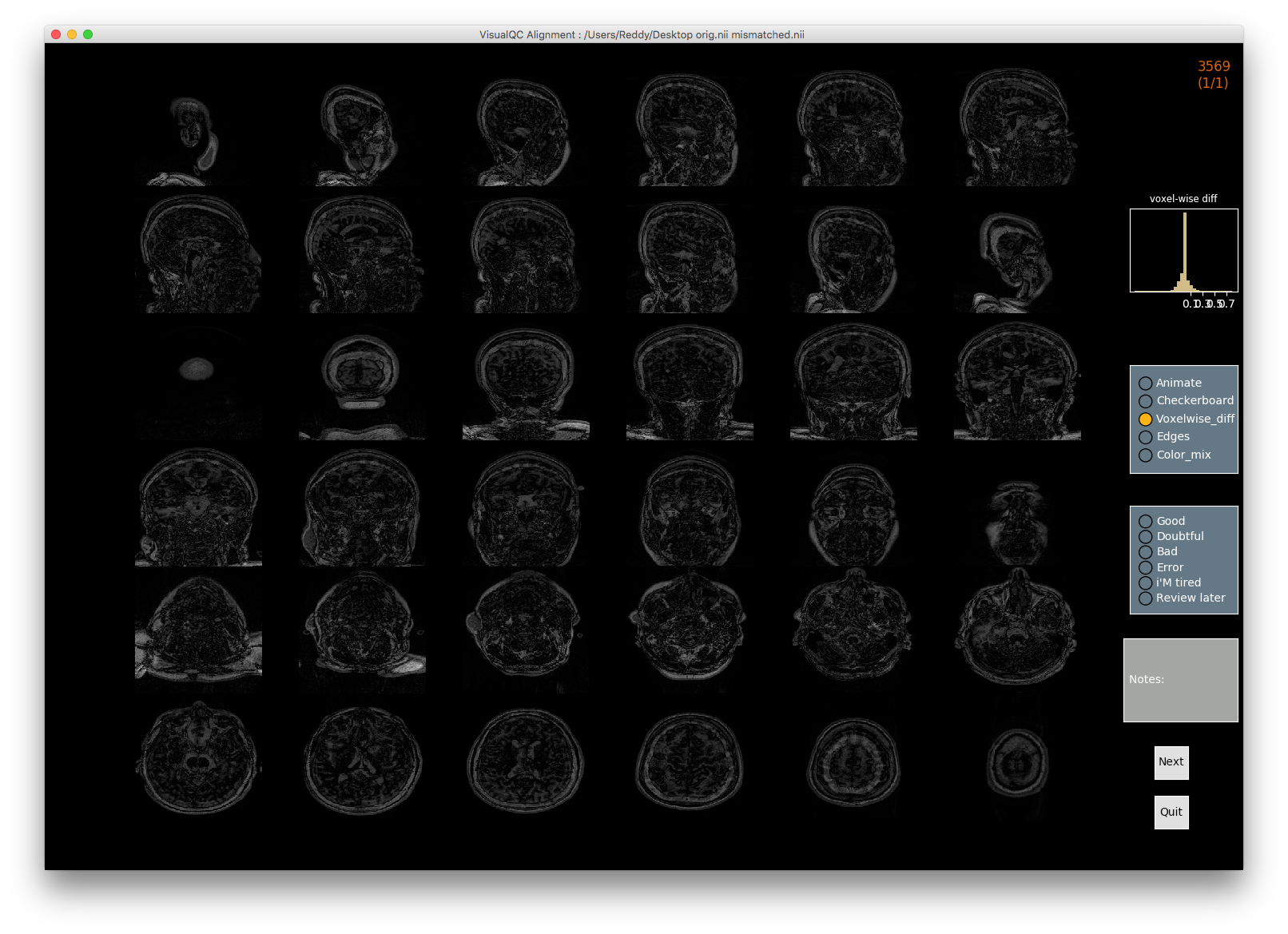_images/alignment_mismatched_diff.png